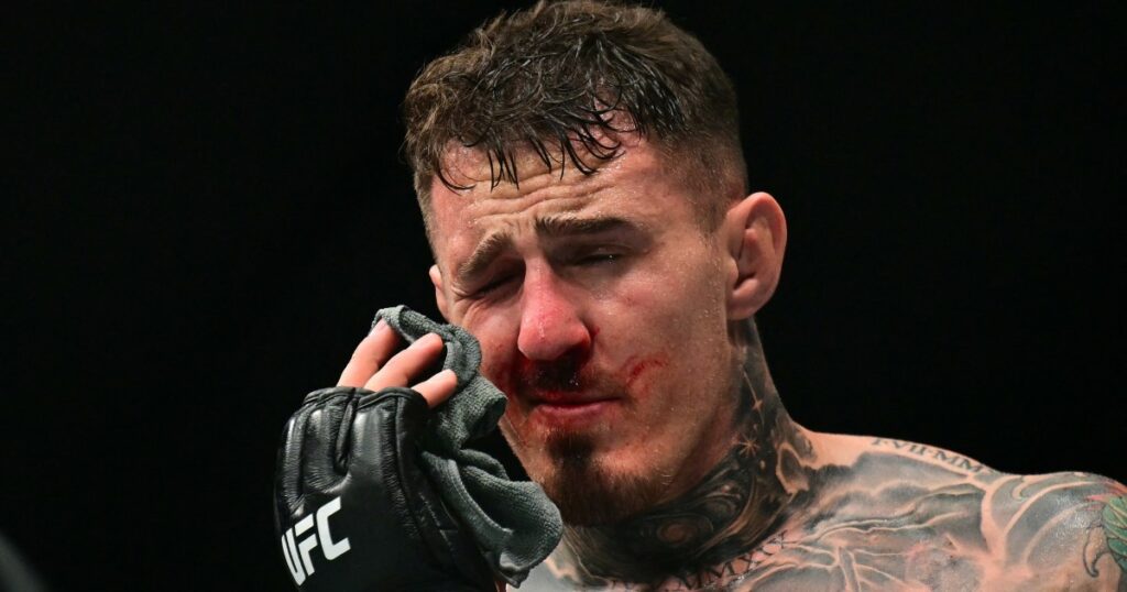 Aspinal Gane UFC 321 title fight ruled no contest due to eye poke | Mixed Martial Arts News